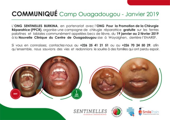 ONG Sentinelle Ouaga _ Chirurgie réparatrice